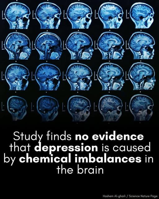 depression is not a chemical imbalance in the brain